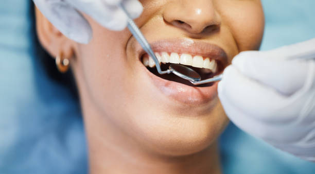 Best Emergency Treatment for Dental Infections or Abscesses in Romulus, MI