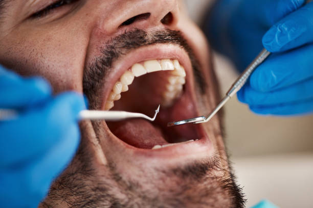 Best Emergency Dental Care for Broken or Chipped Teeth in Romulus, MI