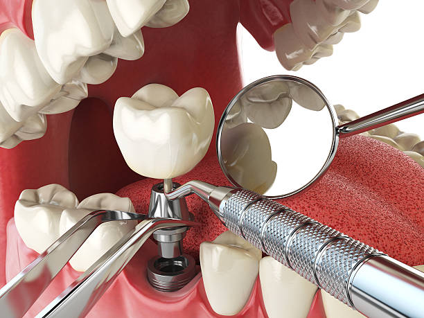 Best Emergency Gum Treatment in Romulus, MI